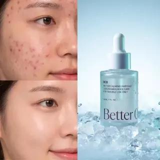 BCB 베러 카밍 수분 여드름 앰플 진정 지성 피부 유수분 피지 밸런스 조절용