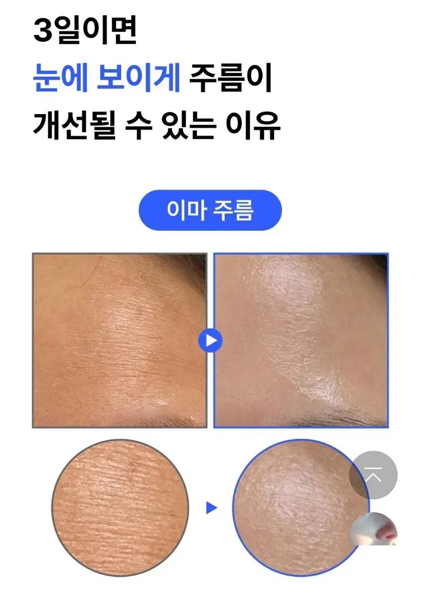 피부과X한번만발라도 효과팔자 주름 기미탄력EGF FGF 콜라겐세럼