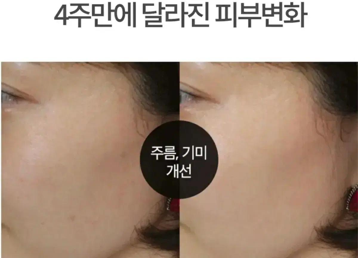 피부과 EGF 세라마이드 여드름 속건조 셀투덤 아쿠아 모이스처 크림