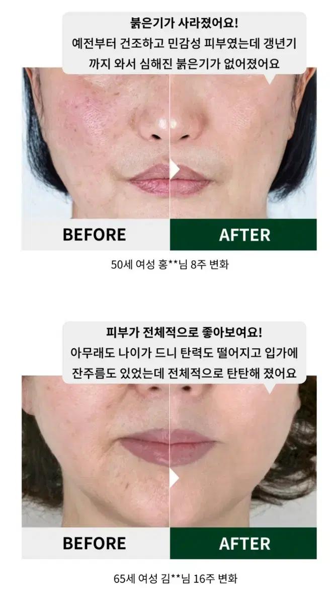 병원판매 EGF 판테놀함유 셀투덤 아쿠아 모이스처 홍조기미 피부장벽 크림