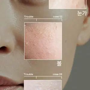 피부요철개선 더마리서치 WITCH BHA 크림 새상품